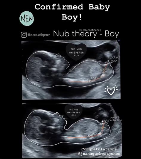 nub theory 13 weeks|nub theory baby scan.